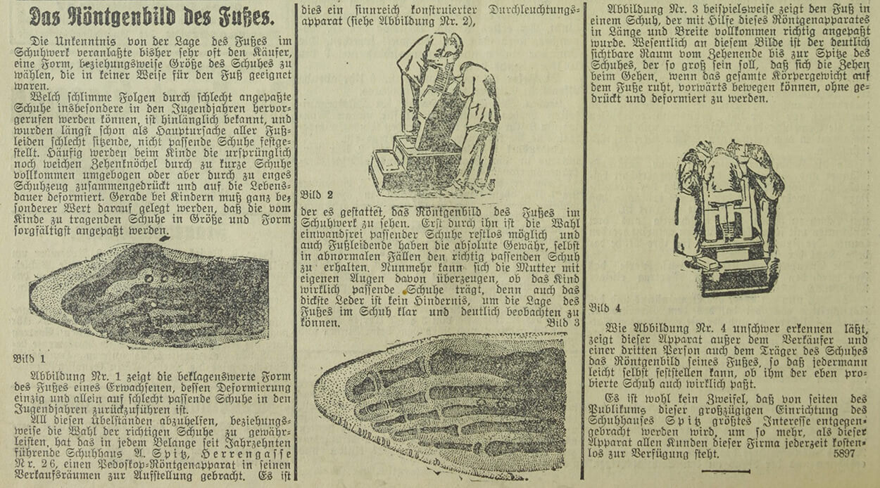 Das Röntgenbild des Fußes, in: Arbeiterwille, 6. November 1927, S. 16, Quelle: ANNO/ÖNB 