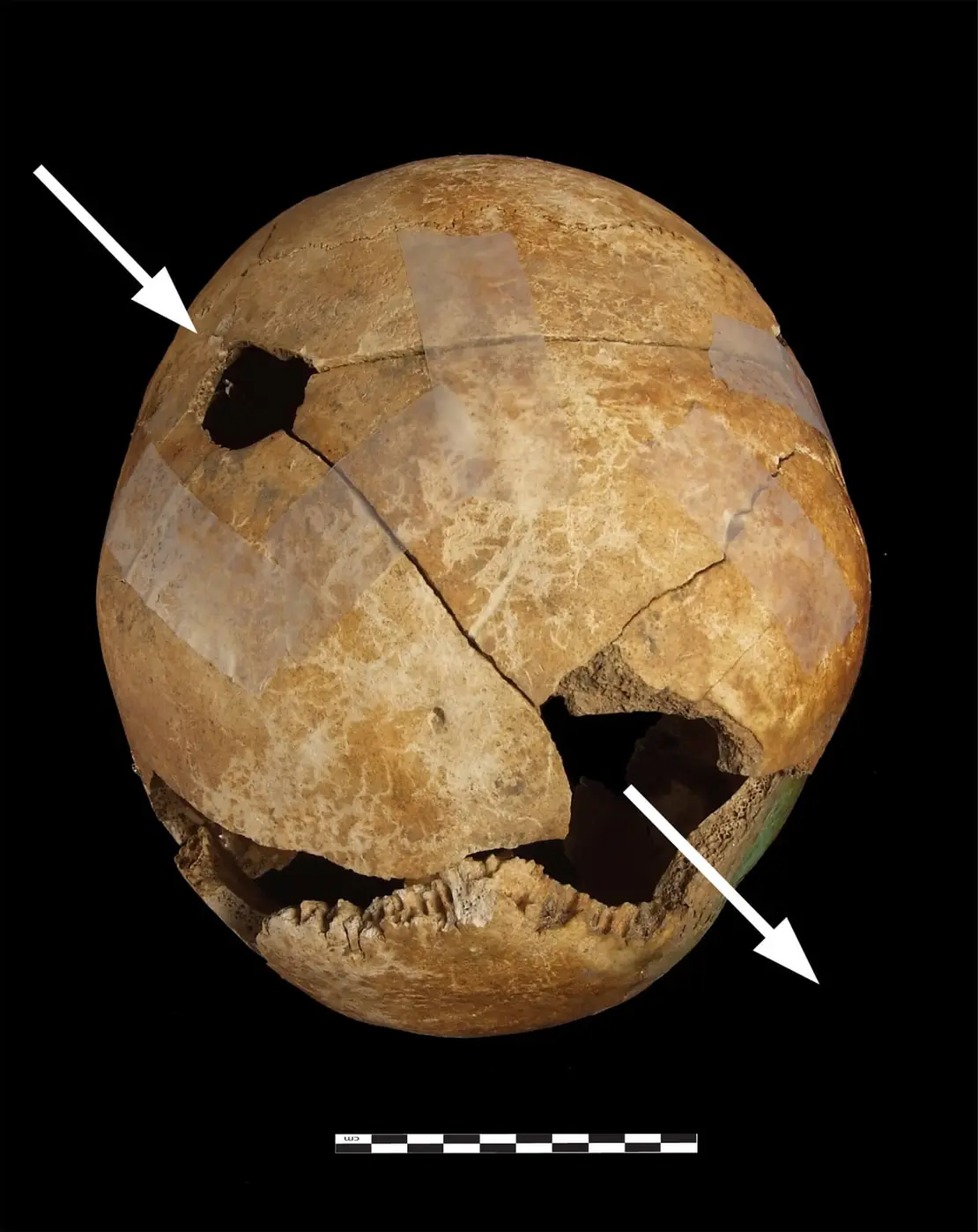 Schädel mit Schussverletzungen, Foto: Michaela Binder