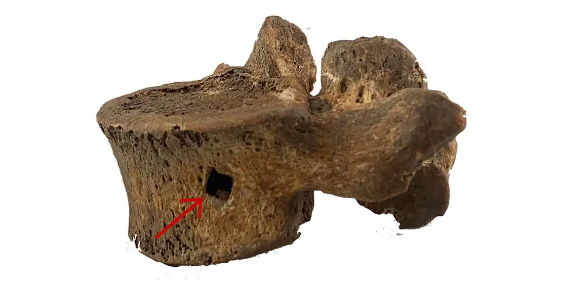 Lendenwirbel mit Eisenbolzen-Trauma, Foto: S. Strang, Novetus