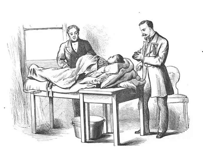 Abbildung aus Spencer Wells „Diseases of the Ovaries“, London, 1872. Bei der Vorbereitung zur Operation ist links der Chirurg Spencer Wells abgebildet, bei der rechten Person könnte es sich um Ferdinand Adalbert Junker von Langegg handeln, der sein Narkosegerät für den Einsatz vorbereitet. Quelle: Google Books